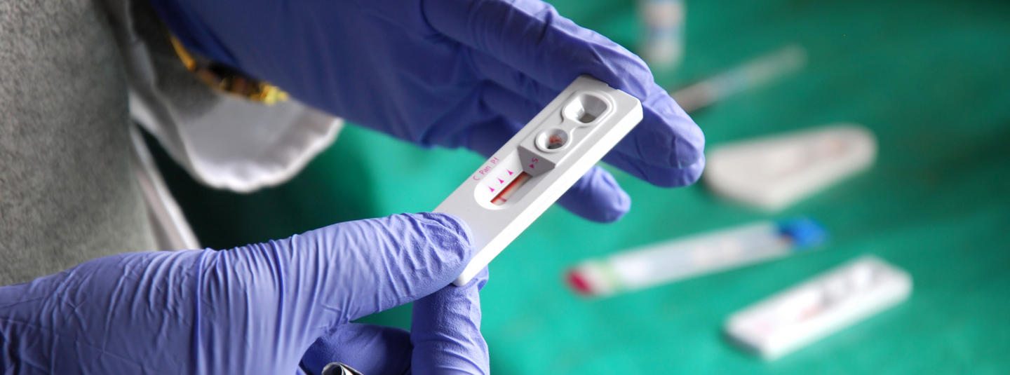 В Одесі охочих тестували на ВІЛ-інфекцію – скільки позитивних результатів виявили