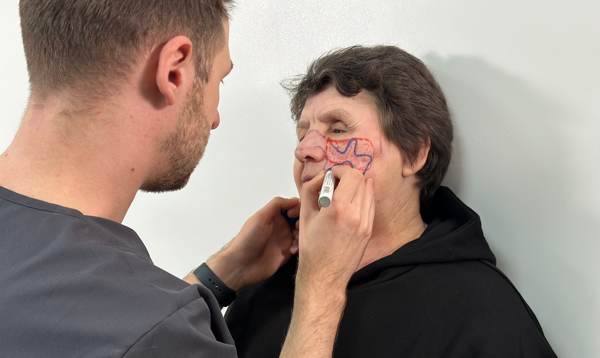 Окупанти поцілили в око: у Львові лікарі відновлюють обличчя жительки Голопристанської громади