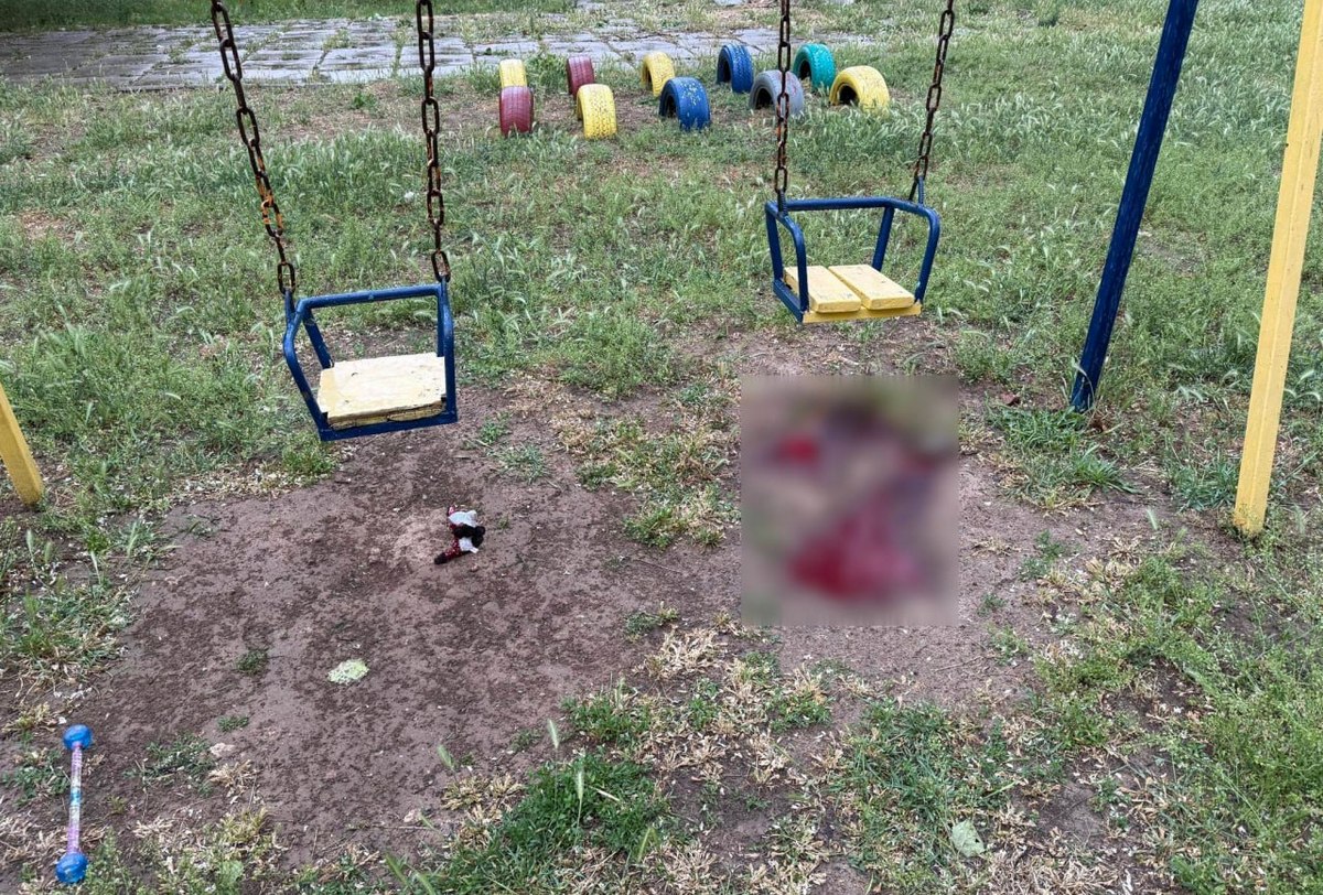 Прокудін розповів про стан дітей та їхньої мами, поранених під час обстрілу Херсона